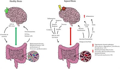 Diet-microbiome-gut-brain nexus in acute and chronic brain injury